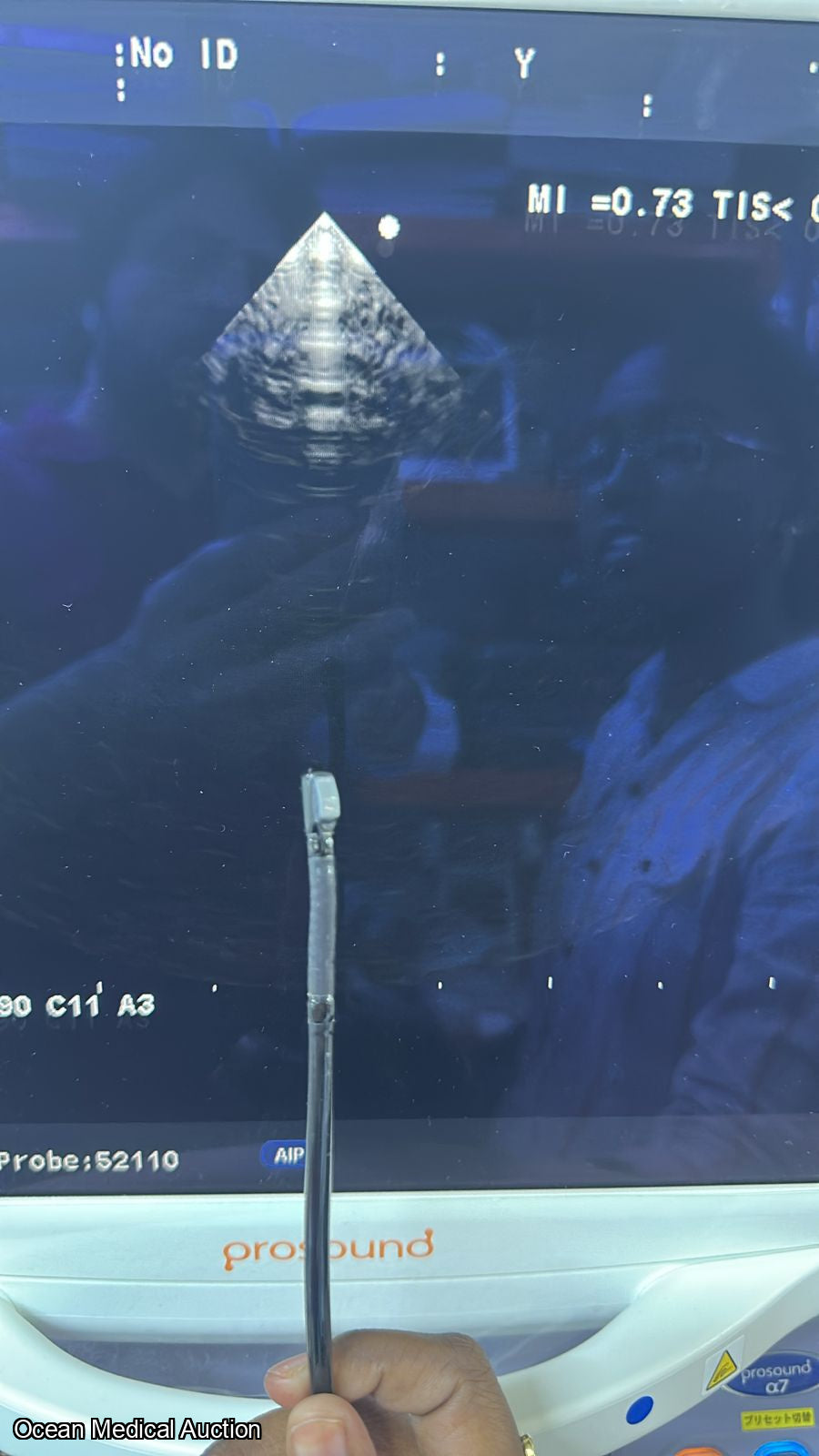 Aloka ust 52110s neonatal / pediatric T.E.E. SN.20004764