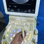 Hitachi avius ultrasound with convex,linear and cardiac probe