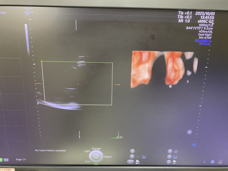 GE voluson E10 (2018 Model) WITH GE RAB / RIC-type 4D Volume Probe