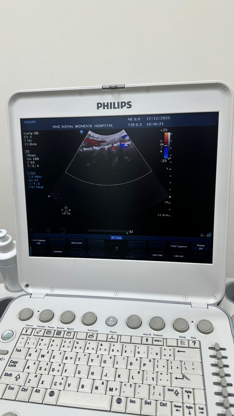 Philips CX50 portable ultrasound with convex and TVS probe