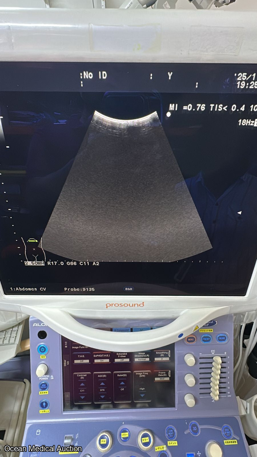 Aloka Ust 9135p curved (convex) array ultrasound transducer / probe.SN.20050045