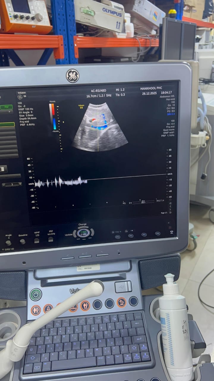 GE Voluson S6 with convex and TVS probe Year 2013