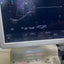 Hitachi Hi Vision preirus ultrasound convex and linear probe