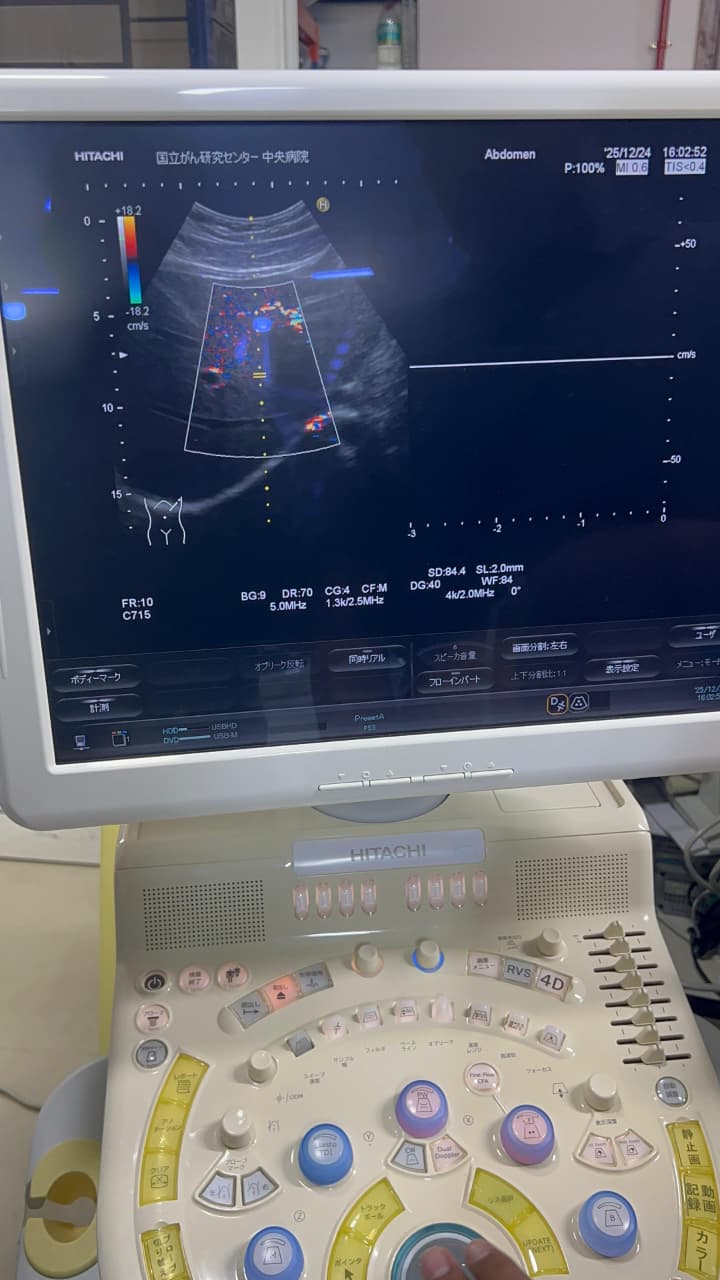 Hitachi Hi Vision preirus ultrasound convex and linear probe