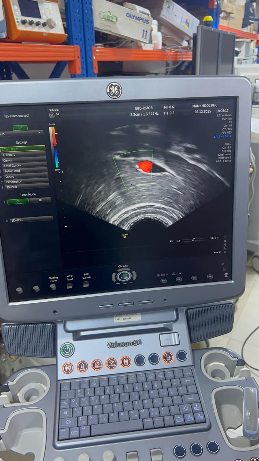 GE Voluson S6 with convex and TVS probe Year 2013