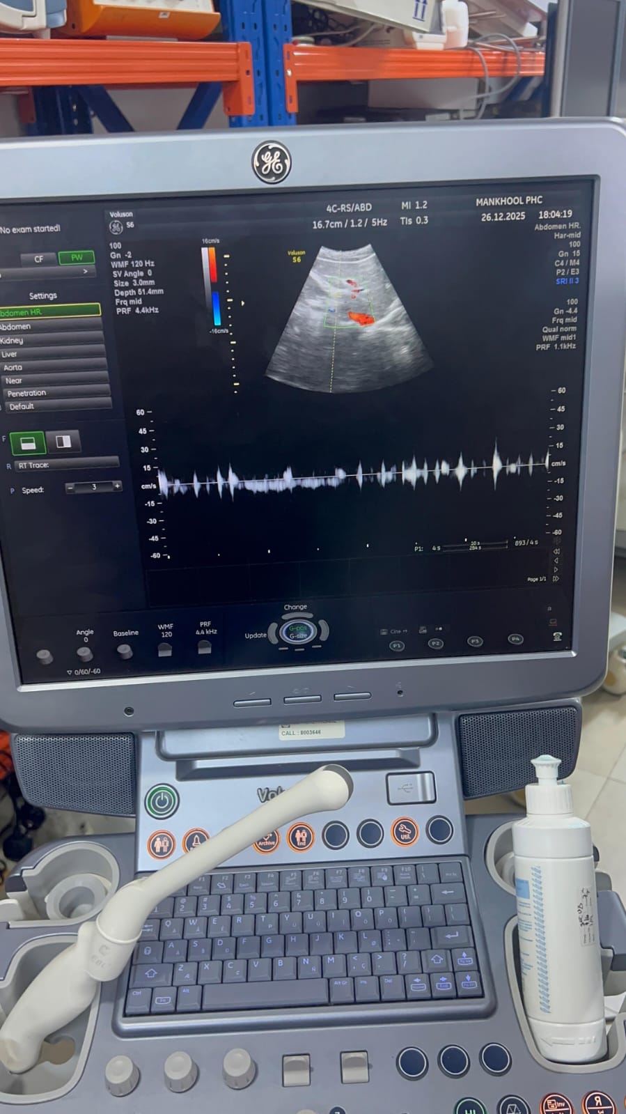 GE Voluson S6 with convex and TVS probe Year 2013