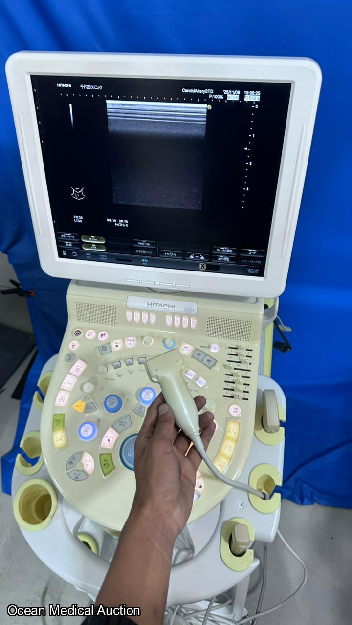 Hitachi avius ultrasound with convex,linear and cardiac probe