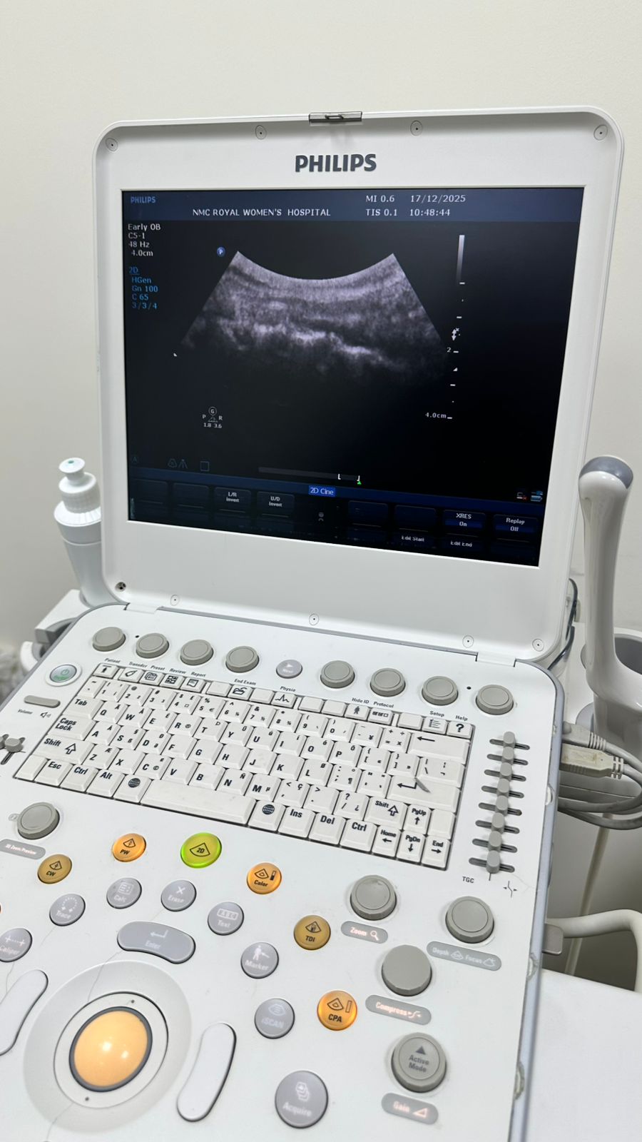 Philips CX50 portable ultrasound with convex and TVS probe