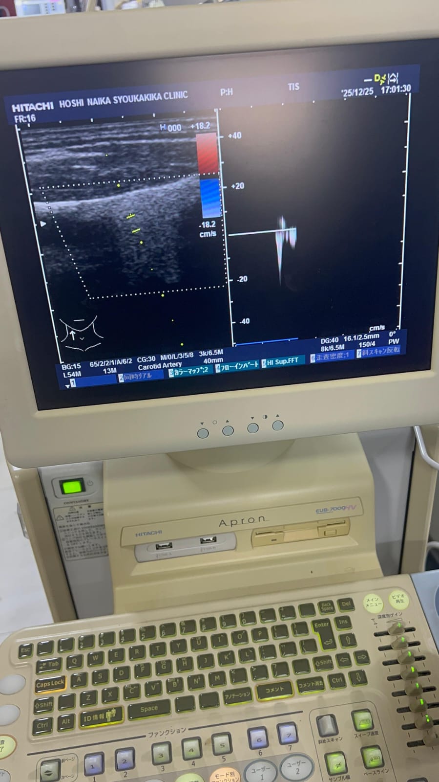 Hitachi apron ultrasound with convex and linear probe