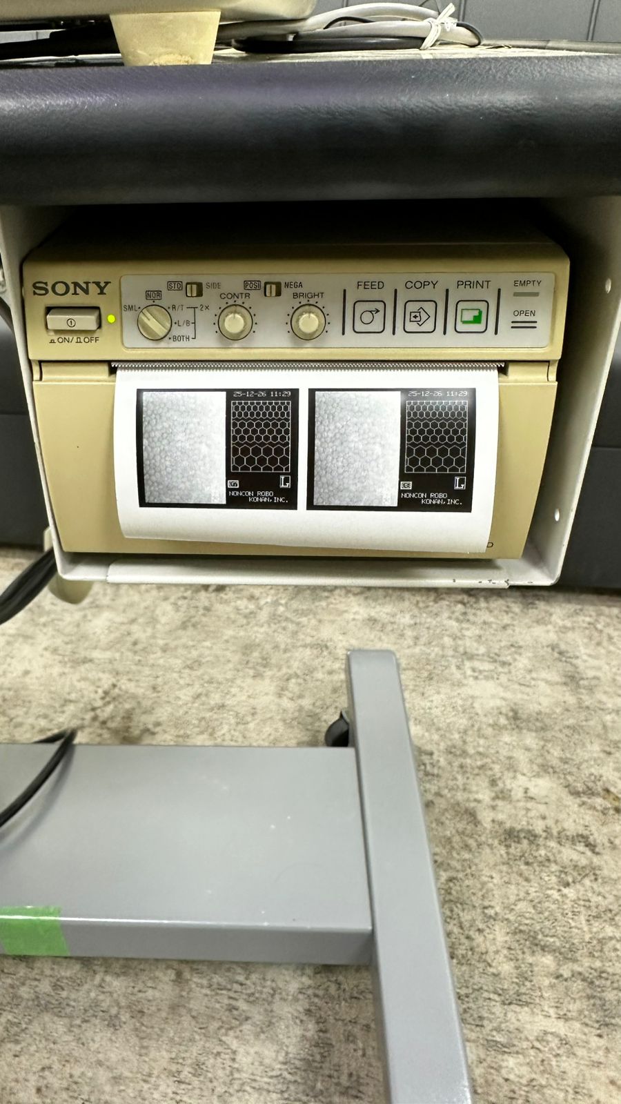 KONAN NONCON ROBO-CA Specular Microscope.