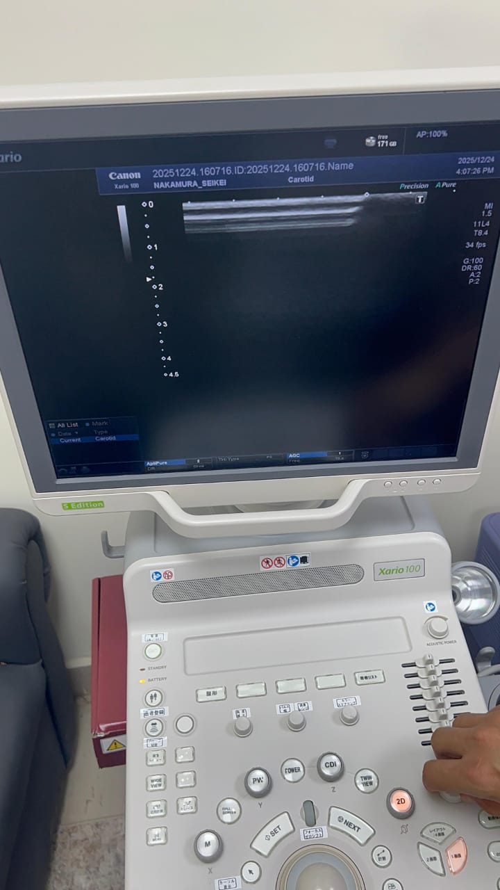Toshiba xario 100 s edition with linear probe