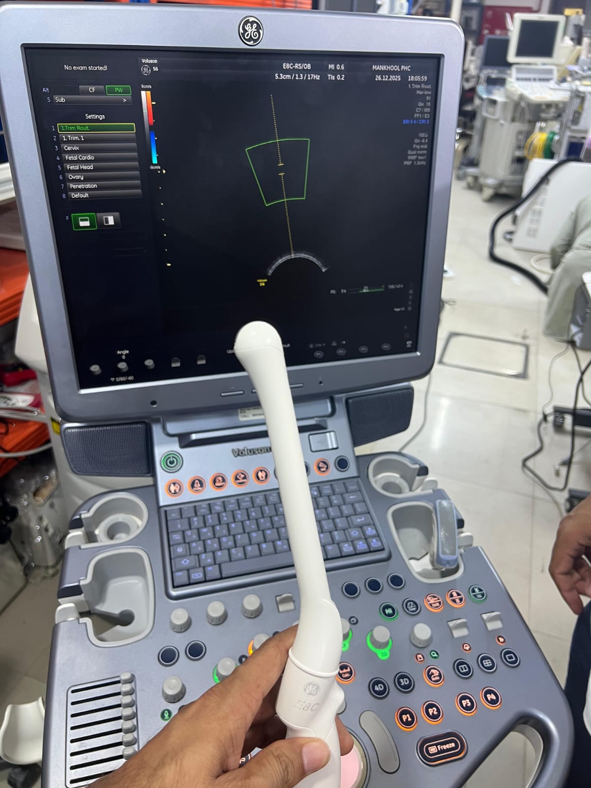 GE Voluson S6 with convex and TVS probe Year 2013