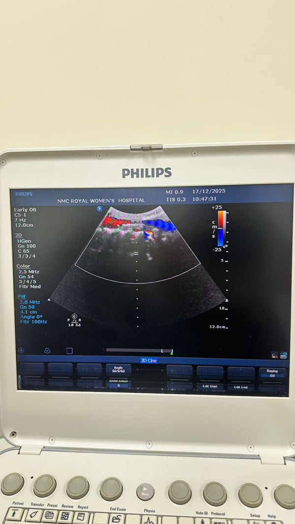 Philips CX50 portable ultrasound with convex and TVS probe