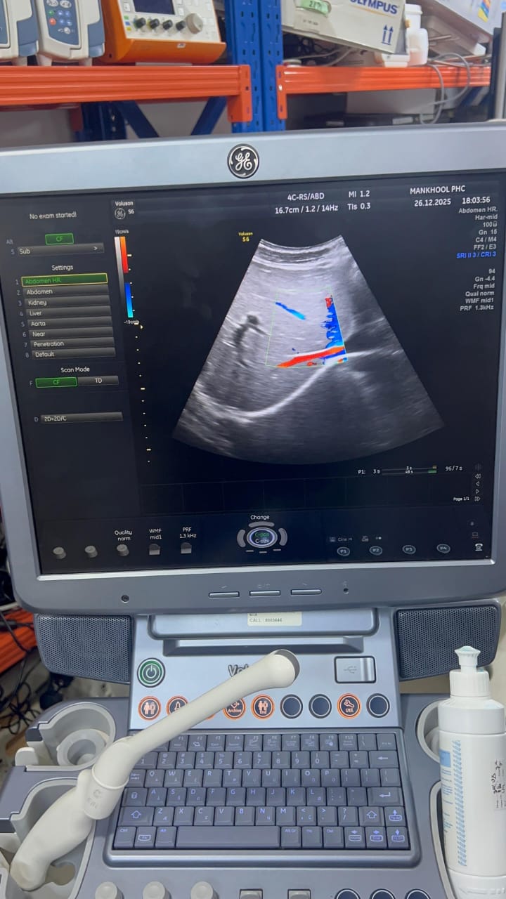 GE Voluson S6 with convex and TVS probe Year 2013