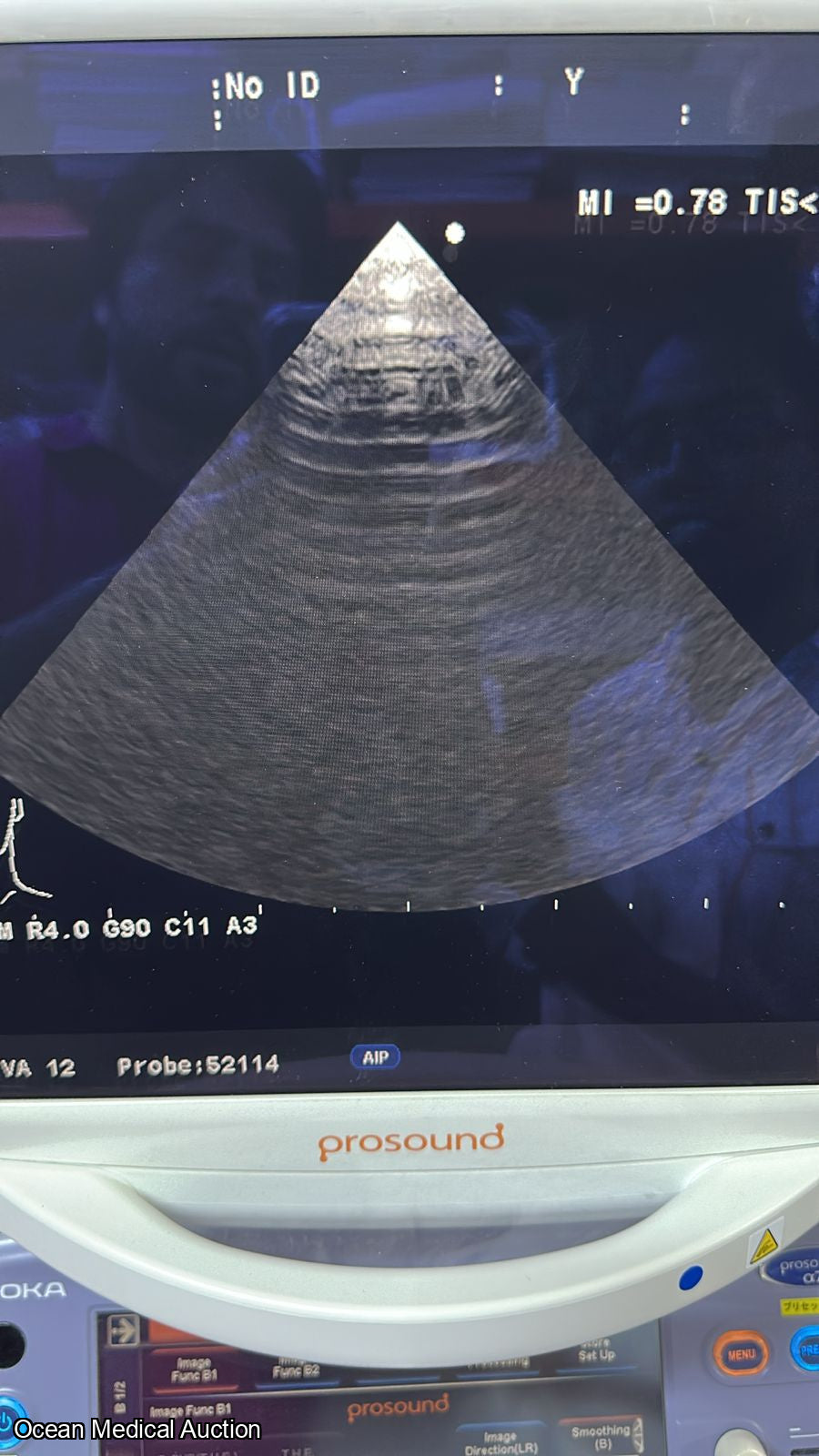 Aloka ust 52114P ntraoperative / phased-array ultrasound transducer (probe) SN.200D3785