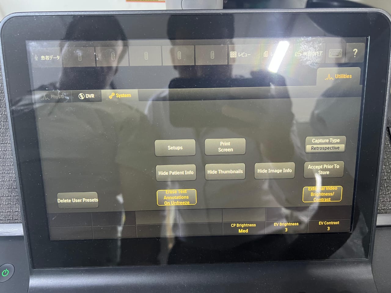 Philips EPIQ 7G ultrasound