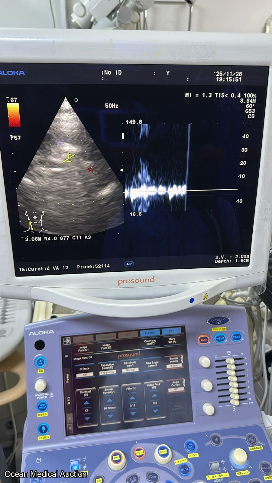 Aloka ust 52114P ntraoperative / phased-array ultrasound transducer (probe) SN.200D3785