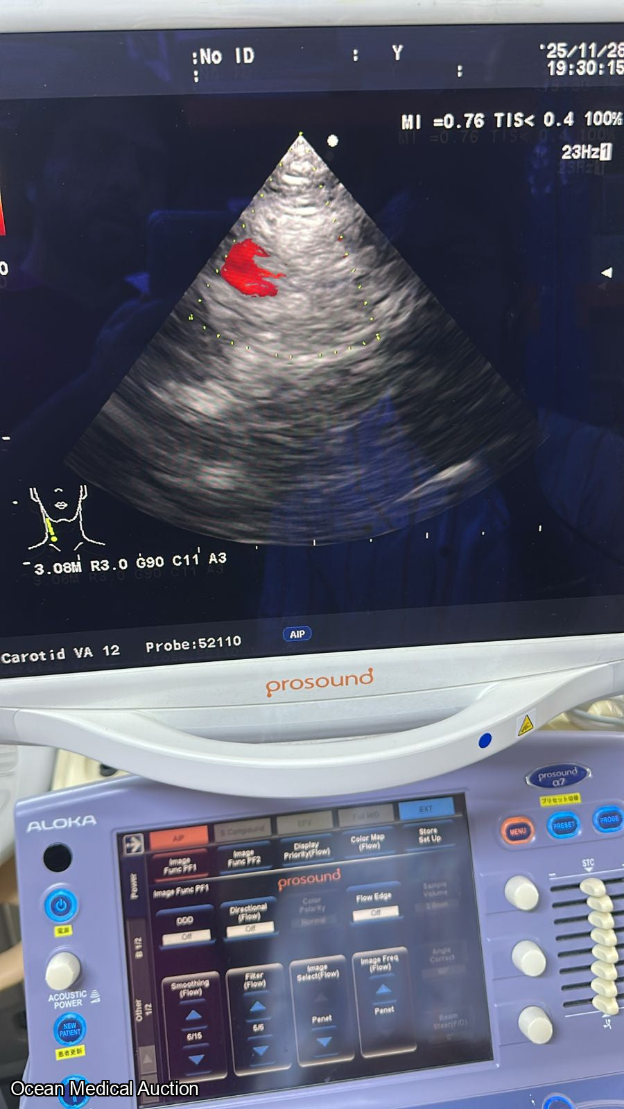 Aloka ust 52110s neonatal / pediatric T.E.E. SN.20004764