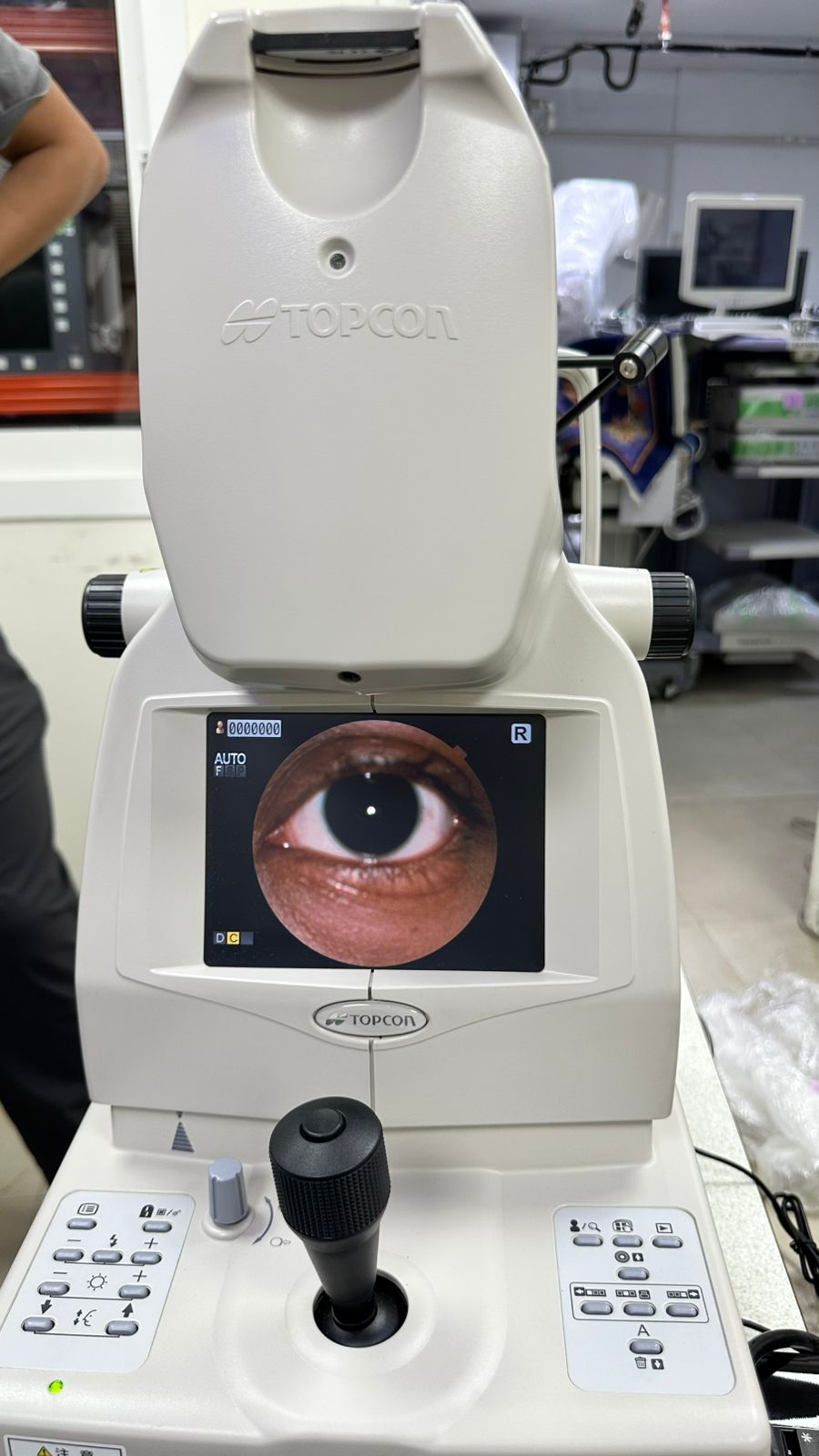 TRC NW300 Retinal camera