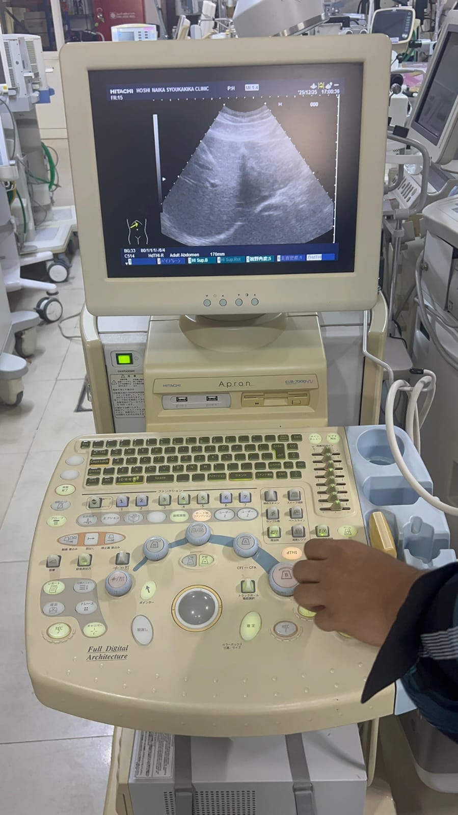 Hitachi apron ultrasound with convex and linear probe