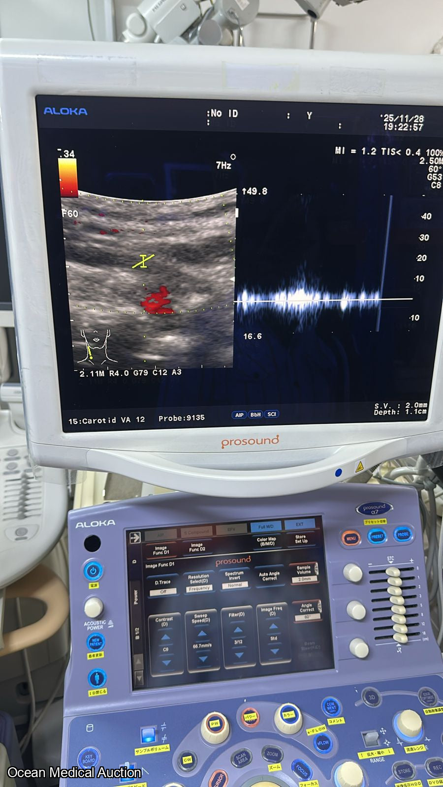 Aloka Ust 9135p curved (convex) array ultrasound transducer / probe.SN.20050045