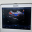 Philips CX50 portable ultrasound with convex and TVS probe