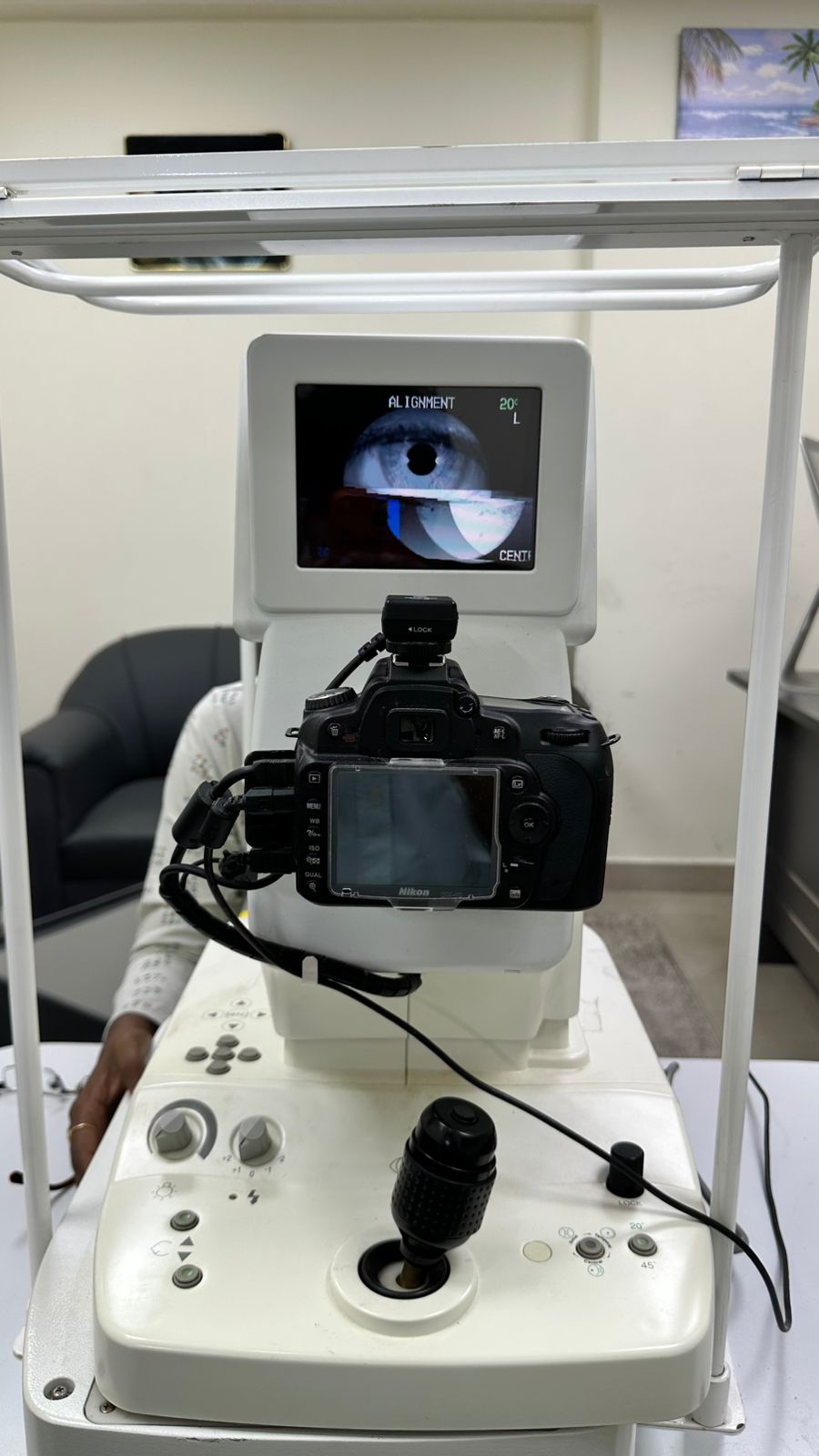 kowa nonmyd 7 fundus camera 12 mega