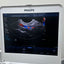 Philips CX50 portable ultrasound with convex and TVS probe