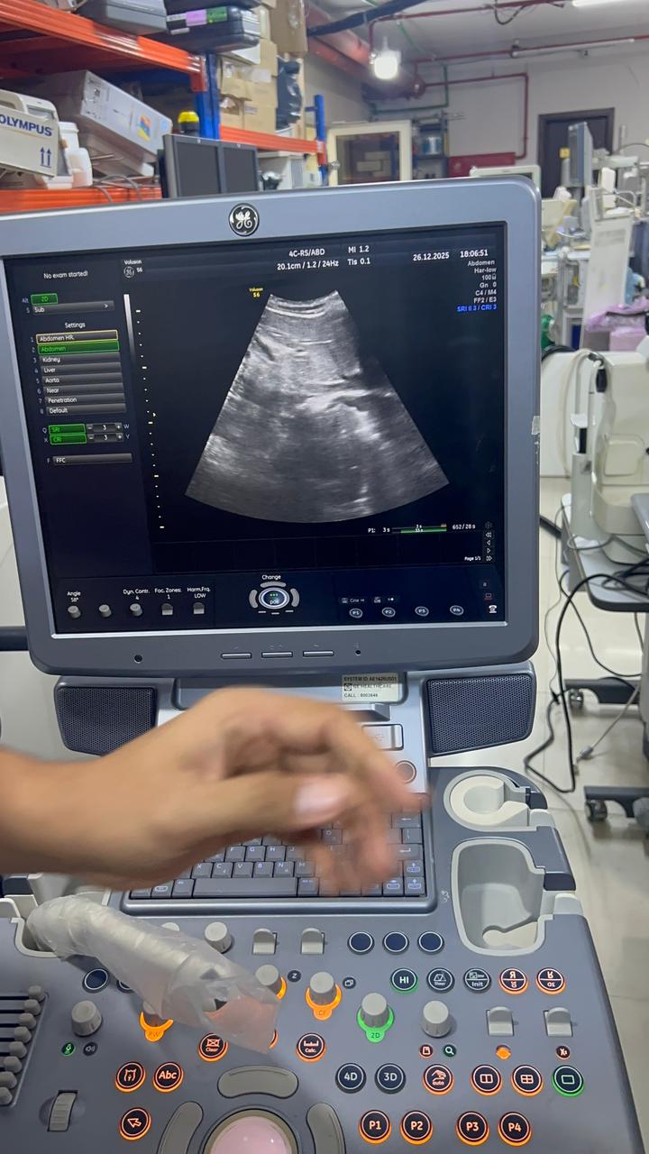 GE Voluson S6 with convex and TVS probe Year 2013