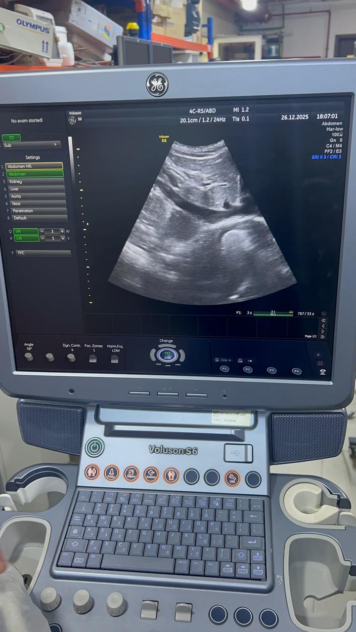 GE Voluson S6 with convex and TVS probe Year 2013