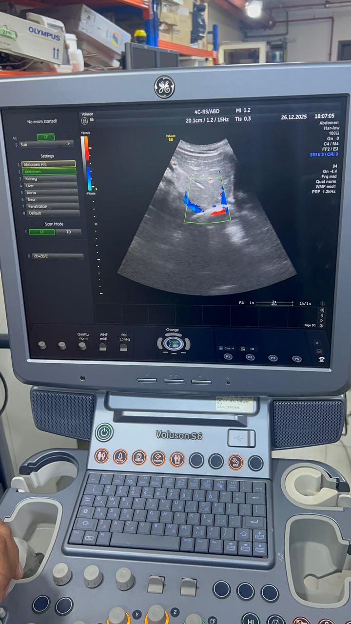 GE Voluson S6 with convex and TVS probe Year 2013