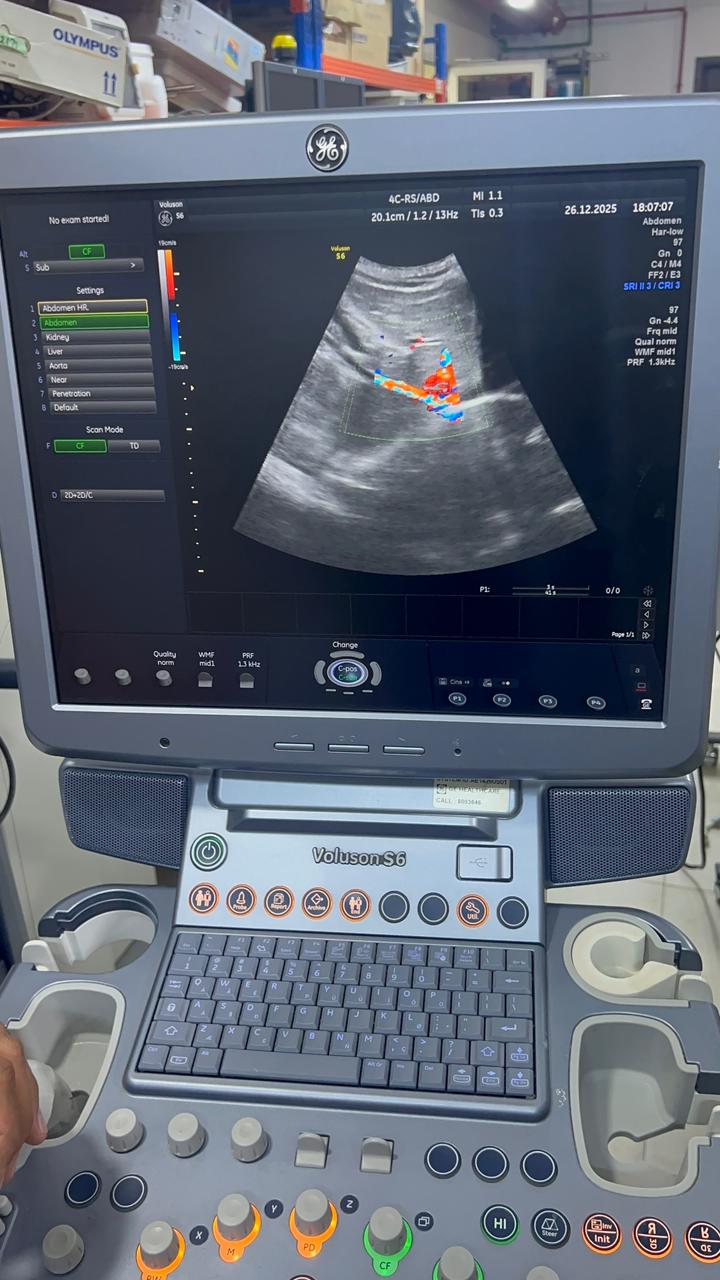 GE Voluson S6 with convex and TVS probe Year 2013