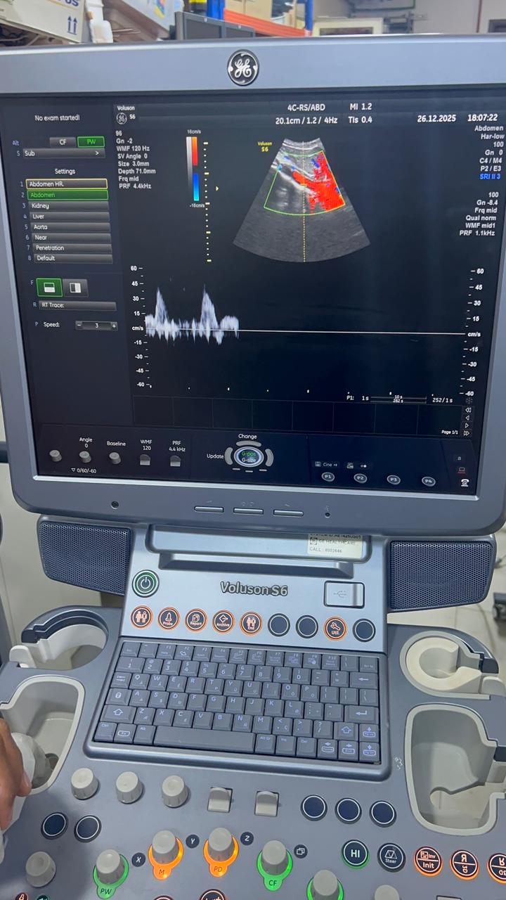 GE Voluson S6 with convex and TVS probe Year 2013