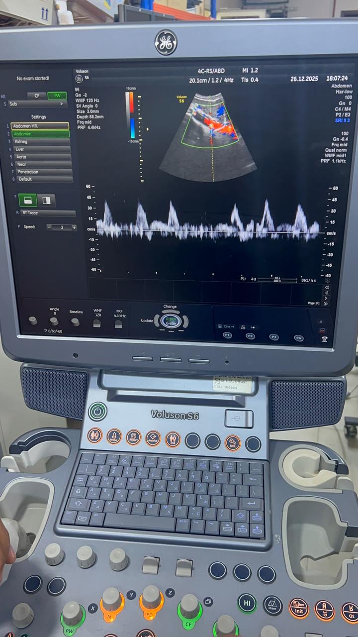 GE Voluson S6 with convex and TVS probe Year 2013