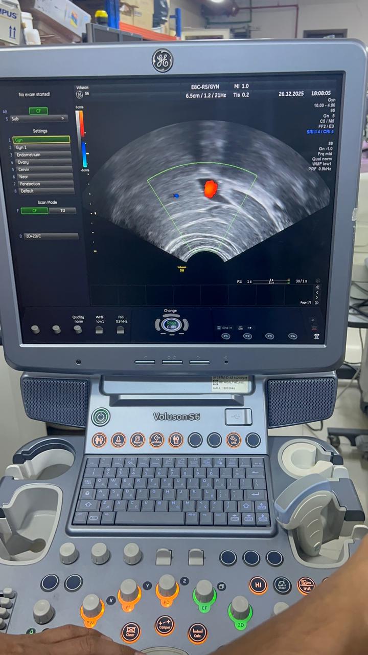 GE Voluson S6 with convex and TVS probe Year 2013
