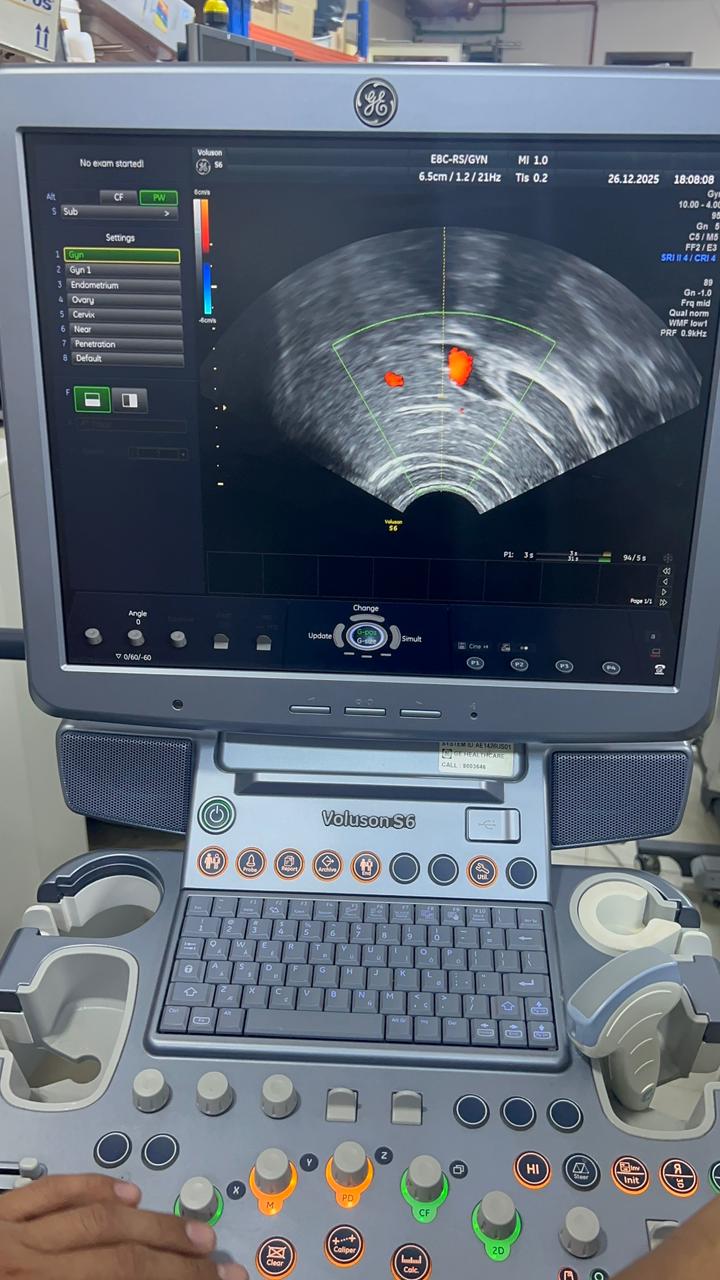 GE Voluson S6 with convex and TVS probe Year 2013
