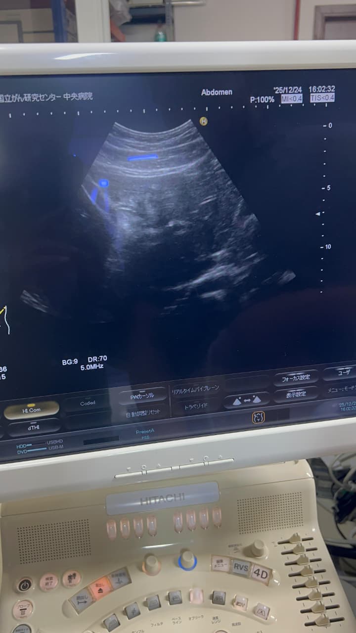 Hitachi Hi Vision preirus ultrasound convex and linear probe