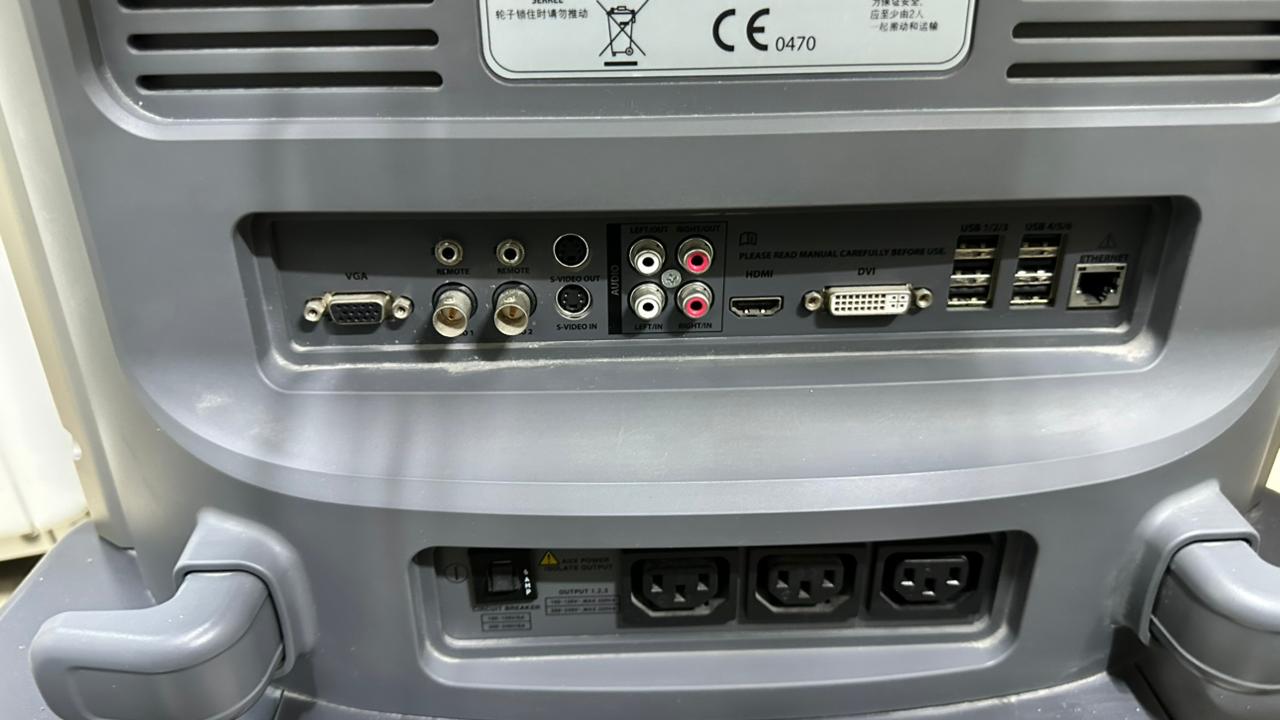 ALPINION E-CUBE 15 ultrasound machine WITH CONVEX, LINEAR, TVS and MICRO CONVEX PROBE