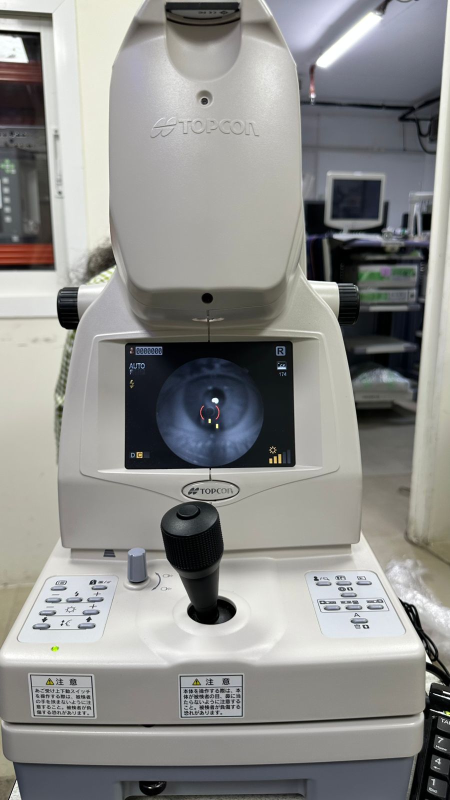 TRC NW300 Retinal camera