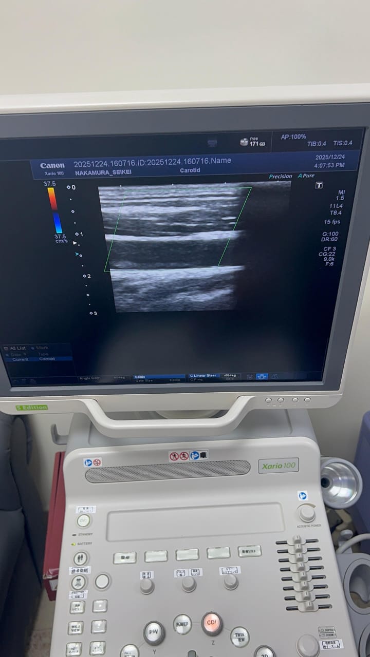 Toshiba xario 100 s edition with linear probe