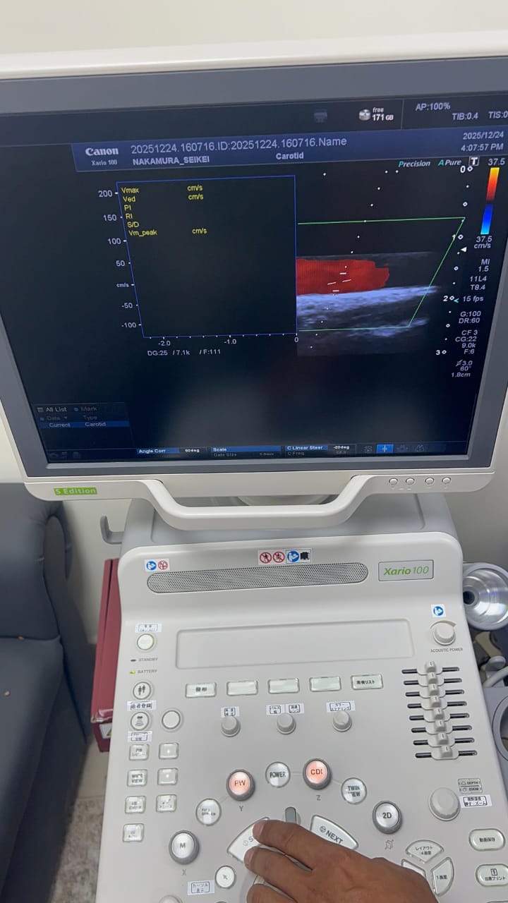 Toshiba xario 100 s edition with linear probe