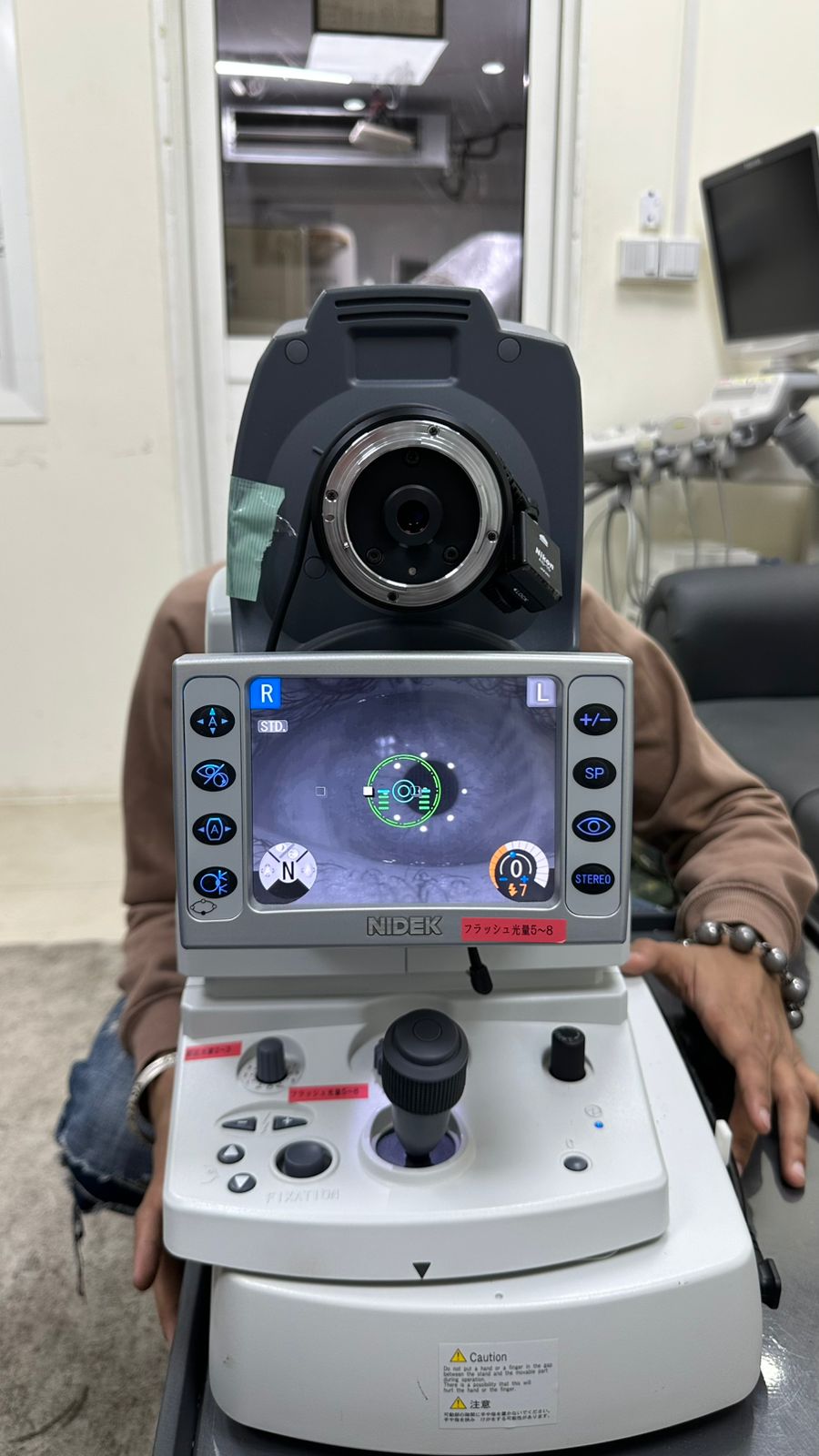 Nidek AFC-210 Non-Mydriatic Auto fundus camera