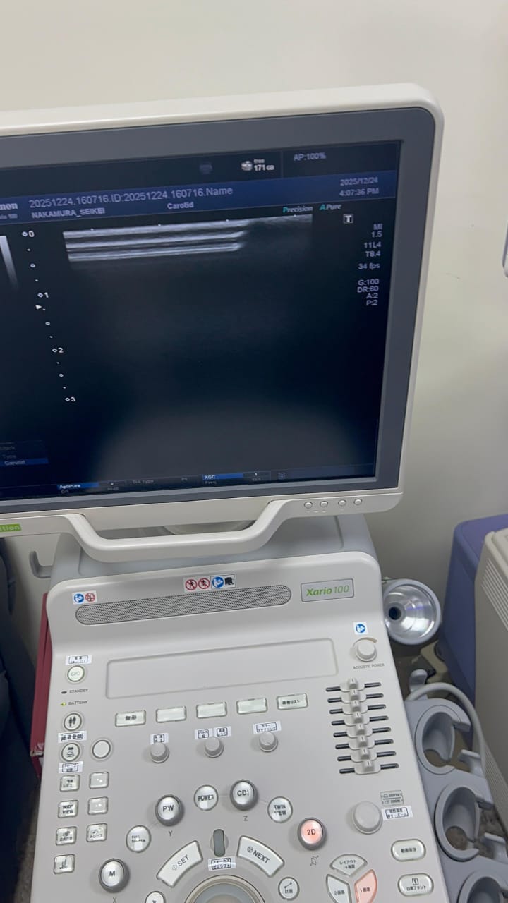 Toshiba xario 100 s edition with linear probe