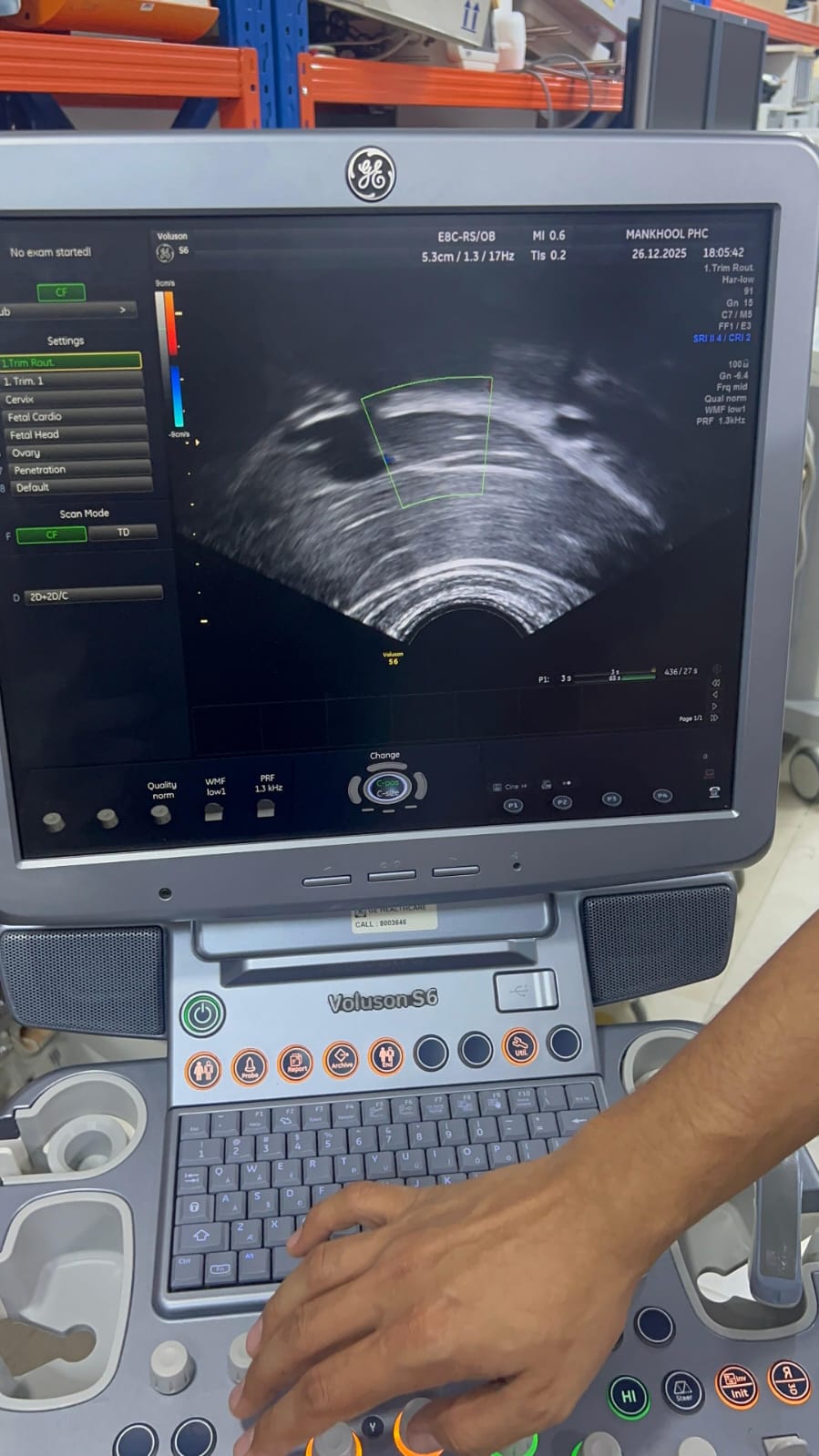 GE Voluson S6 with convex and TVS probe Year 2013