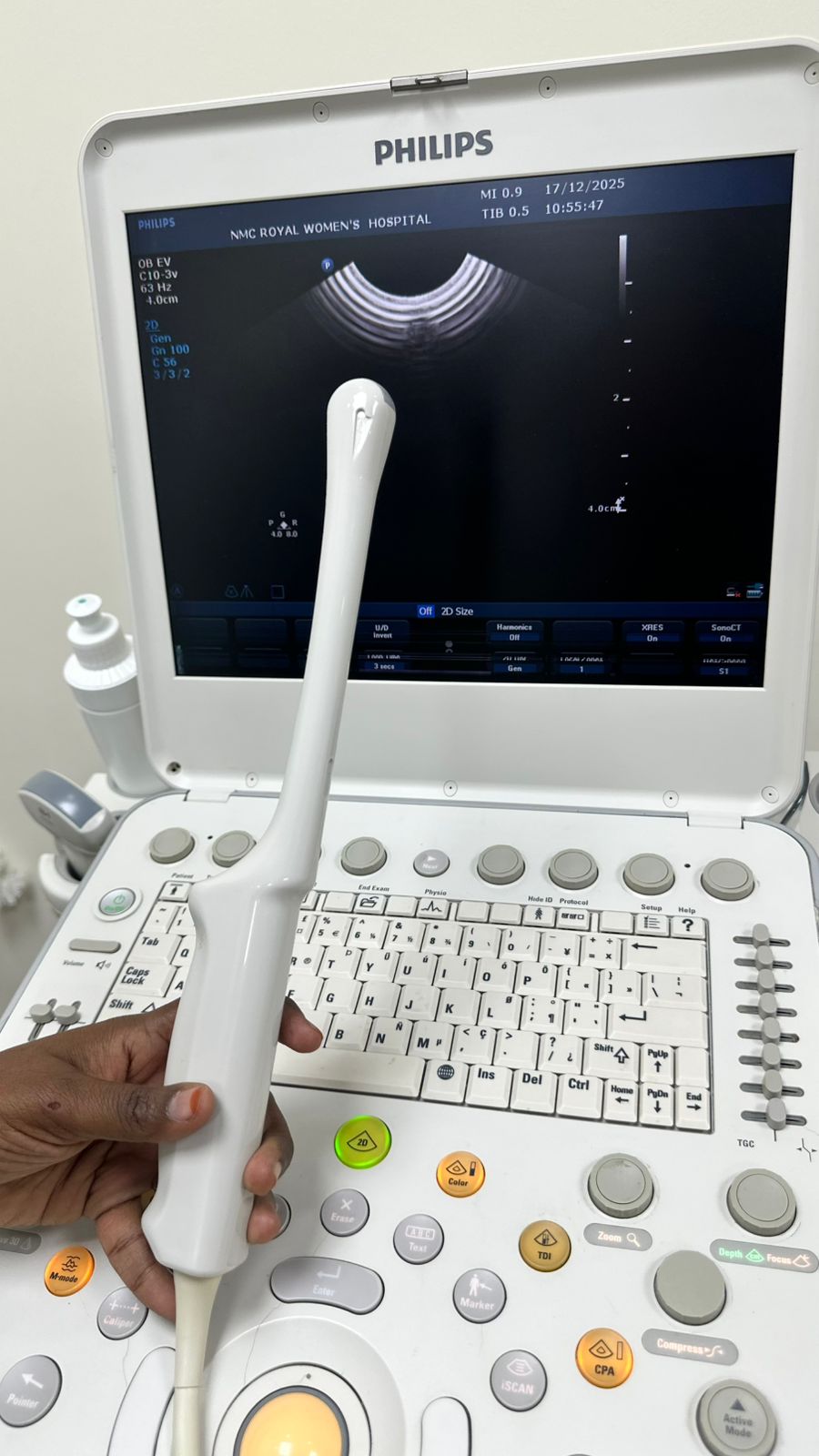 Philips CX50 portable ultrasound with convex and TVS probe