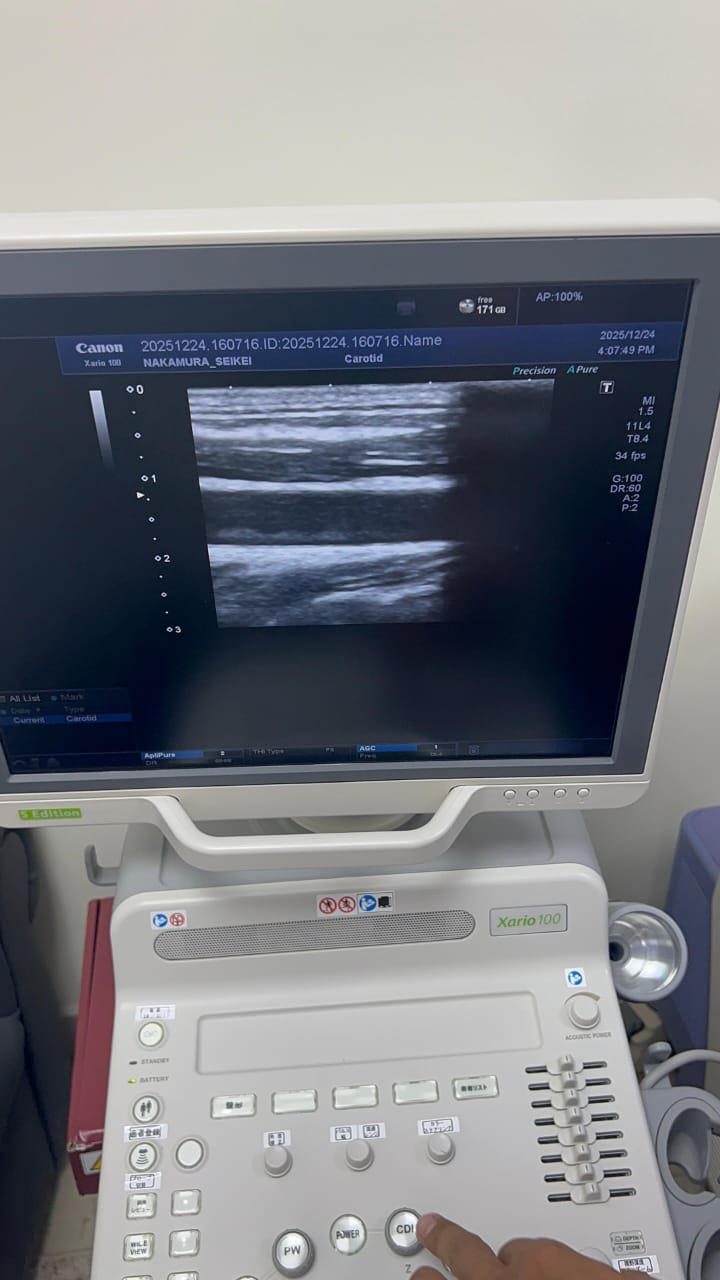 Toshiba xario 100 s edition with linear probe