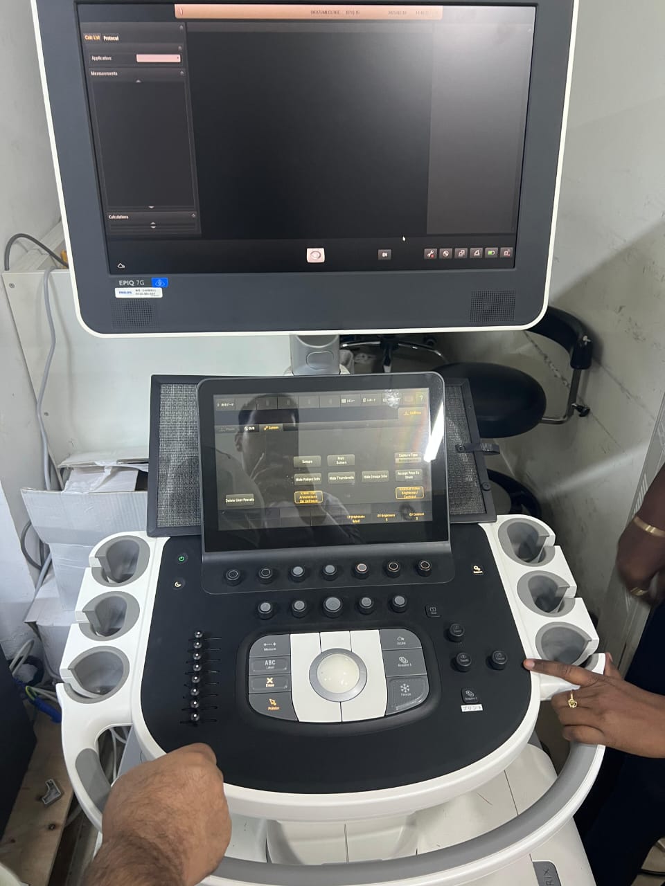 Philips EPIQ 7G ultrasound