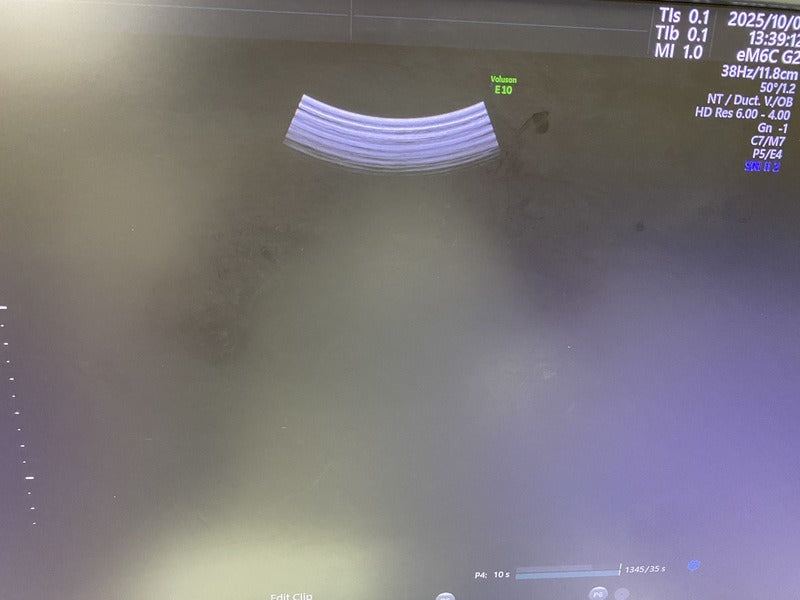 GE voluson E10 (2018 Model) WITH GE RAB / RIC-type 4D Volume Probe