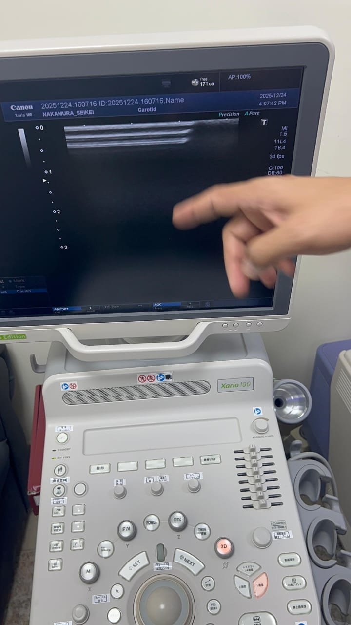 Toshiba xario 100 s edition with linear probe