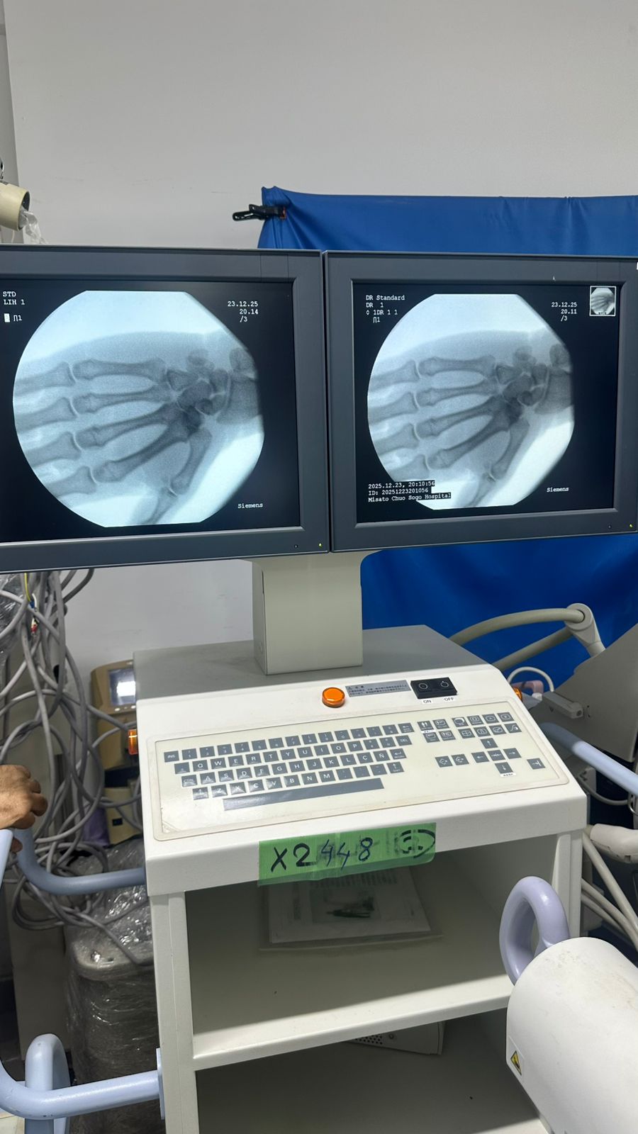 siemens sire mobile compact c-arm maf 2010